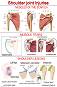 Shoulder Joint Injuries - 80 x 100 cm - 