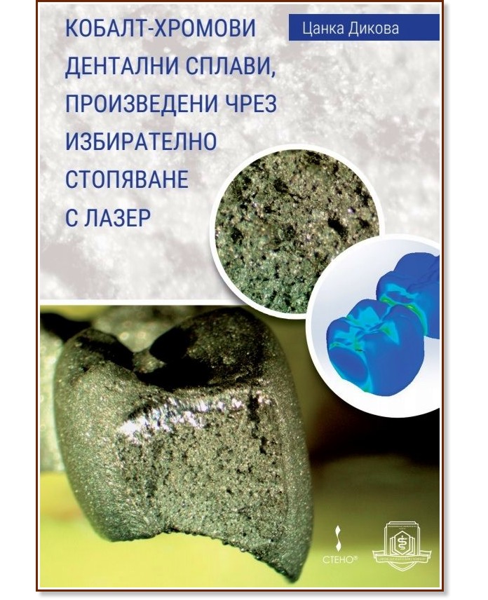Кобалт-хромови дентални сплави, произведени чрез избирателно стопяване ...