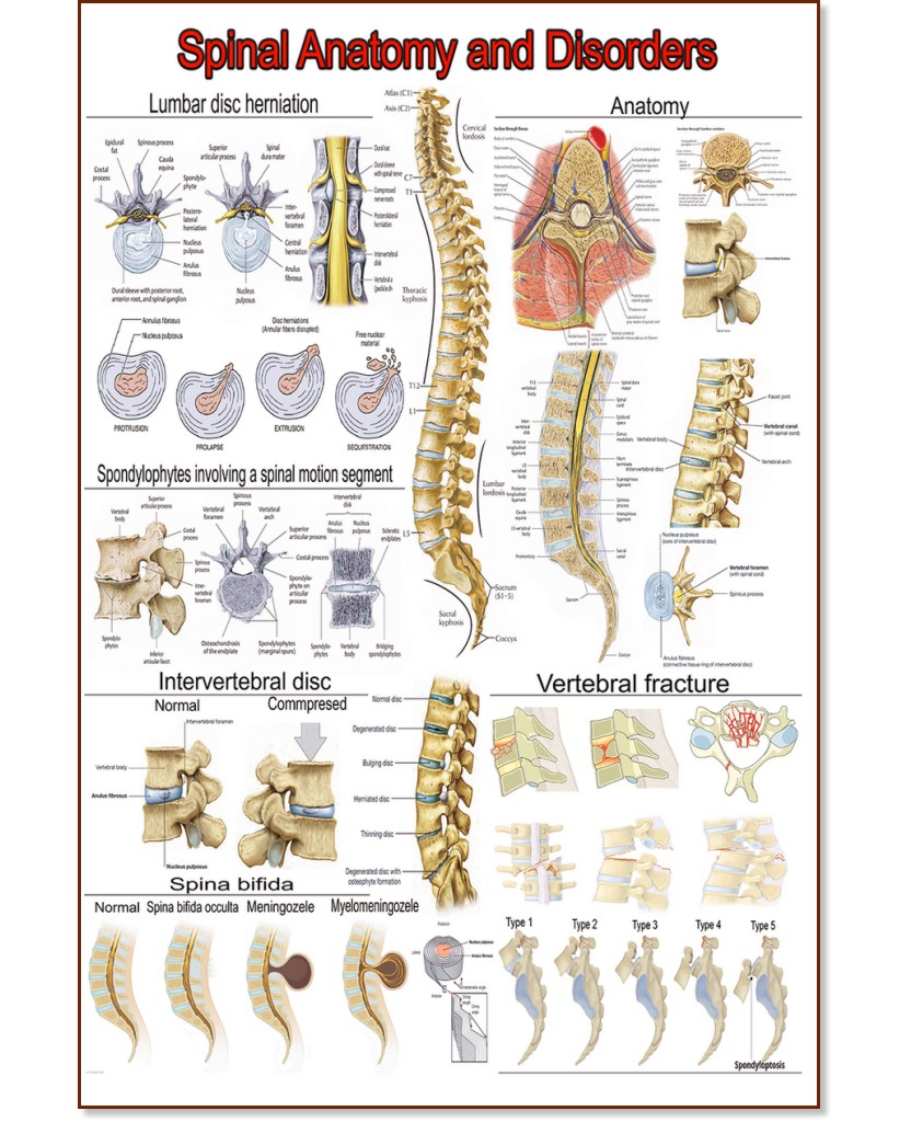 Spinal Anatomy and Disorders - 50 x 70 cm - 