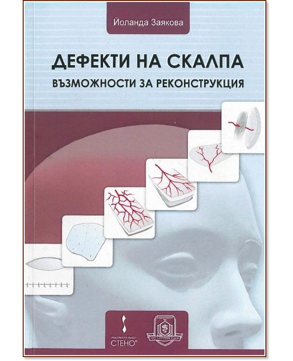 Дефекти на скалпа. Възможности за реконструкция Дефекти на скалпа. Възможности за реконструкция - Йоланда Заякова - книга