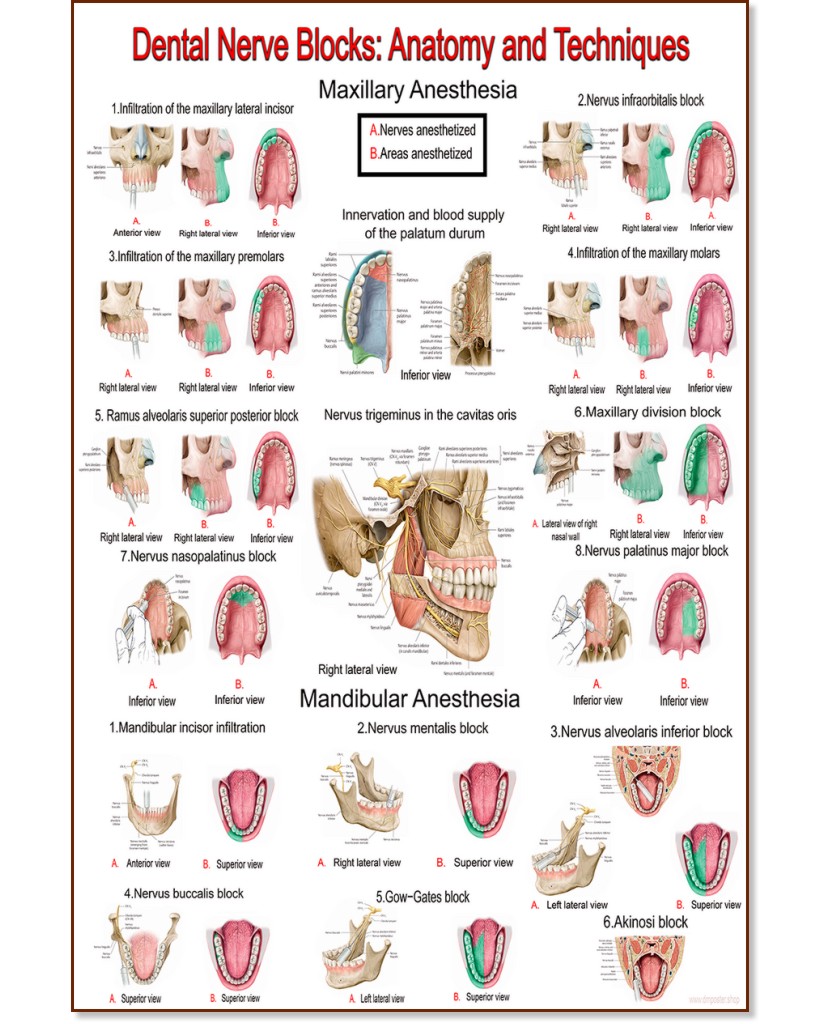 Dental Nerve Blocks: Anatomy & Techniques - 80 x 100 cm - 