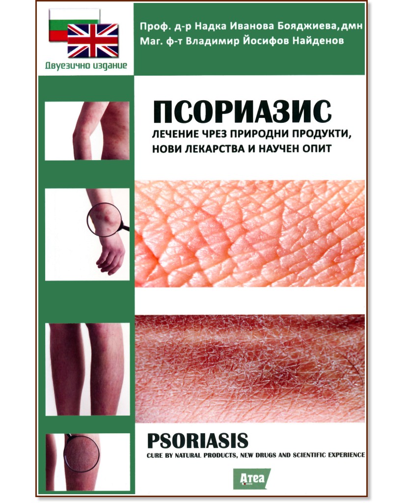 :    ,      : Psoriasis: Cure by natural products, new drugs and scientific experience - . -   , . -    - 