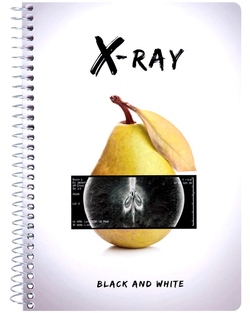     - X-ray :  5    - 1  5  - 