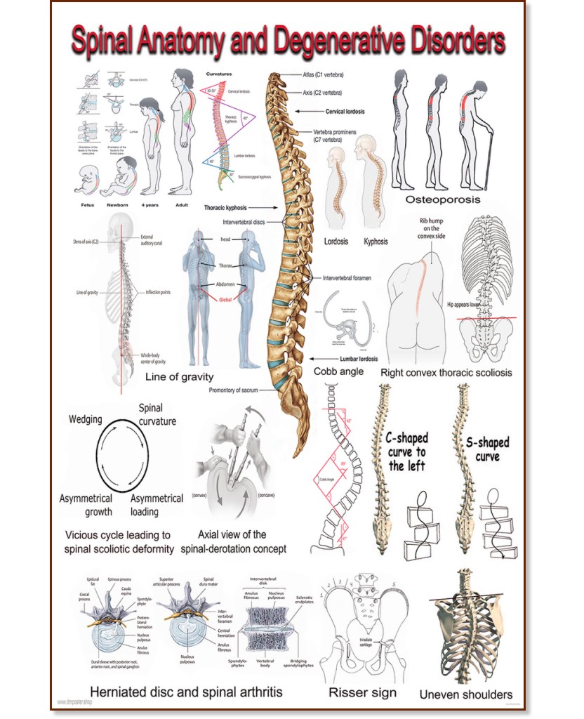 Spinal Anatomy and Degenerative Disorders - 80 x 100 cm - 