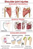 Shoulder Joint Injuries - 80 x 100 cm - 