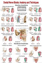 Dental Nerve Blocks: Anatomy & Techniques - 