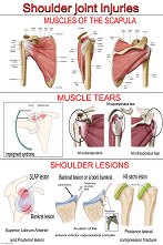 Shoulder Joint Injuries - 